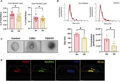 Extracellular vesicles of human diabetic retinopathy retinal tissue and urine of diabetic retinopathy patients are enriched for the junction plakoglo bin protein